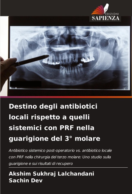 Destino degli antibiotici locali rispetto a quelli sistemici con PRF nella guarigione del 3° molare - Akshim Sukhraj Lalchandani, Sachin Dev