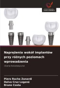 Cover-Bild zum Titel 'Napr¿¿enia wokó¿ implantów przy ró¿nych poziomach wprowadzenia' von 'Piero Rocha Zanardi, Dalva Cruz Laganá, Bruno Costa'