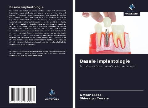 Basale implantologie - Omkar Sakpal, Shivsagar Tewary