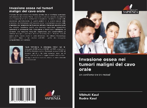 Invasione ossea nei tumori maligni del cavo orale - Vibhuti Kaul, Rudra Kaul