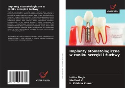 Cover-Bild zum Titel 'Implanty stomatologiczne w zaniku szcz¿ki i ¿uchwy' von 'Ishita Singh, Madhuri V., U. Krishna Kumar'