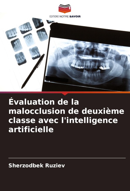 Évaluation de la malocclusion de deuxième classe avec l'intelligence artificielle - Sherzodbek Ruziev