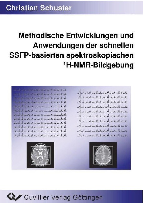 Methodische Entwicklungen und Anwendungen derschnellen SSFP-basierten spektroskopischen 1H-NMR-Bildgebung - 