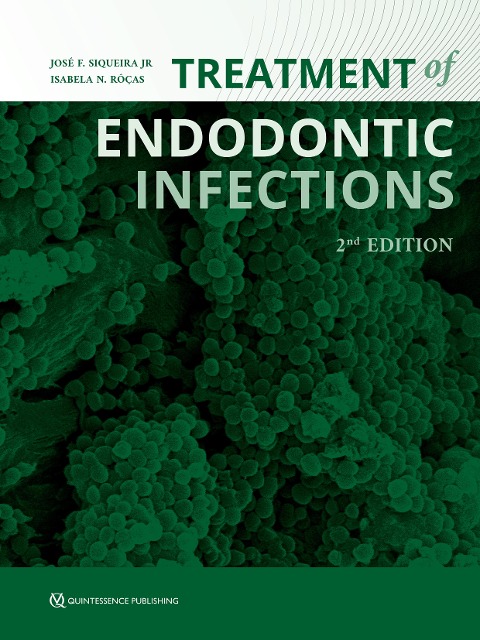 Treatment of Endodontic Infections - 