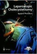 Laparoscopic Cholecystectomy - Surgical Procedure - 