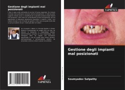 Gestione degli impianti mal posizionati - Soumyadev Satpathy