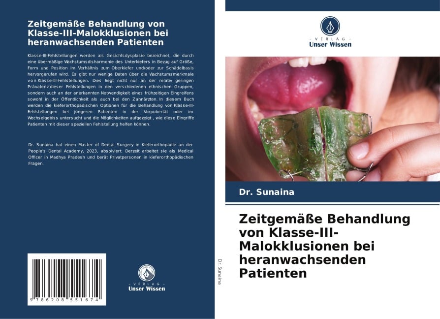 Zeitgemäße Behandlung von Klasse-III-Malokklusionen bei heranwachsenden Patienten - Sunaina