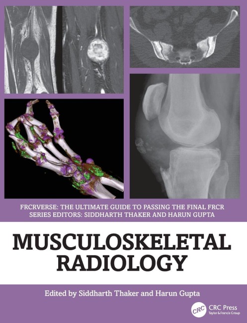 Musculoskeletal Radiology - 