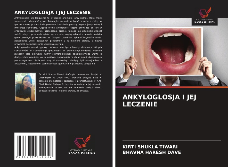 ANKYLOGLOSJA I JEJ LECZENIE - Kirti Shukla Tiwari, Bhavna Haresh Dave