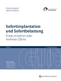 Sofortimplantation und Sofortbelastung - France Lambert, Adam Hamilton