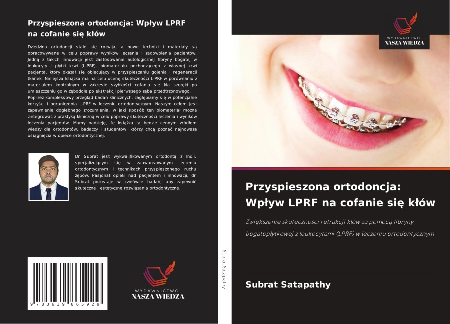 Przyspieszona ortodoncja: Wp¿yw LPRF na cofanie si¿ k¿ów - Subrat Satapathy
