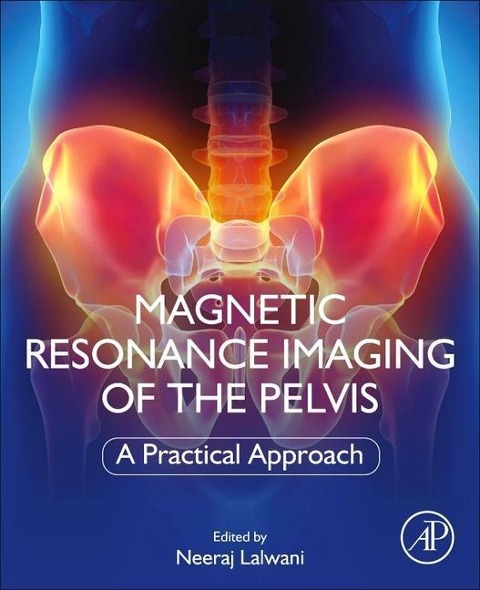 Magnetic Resonance Imaging of the Pelvis - 
