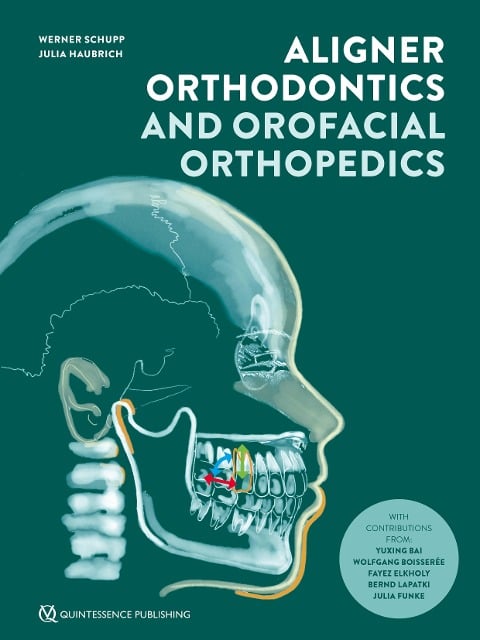 Aligner Orthodontics and Orofacial Orthopedics - Werner Schupp, Julia Haubrich