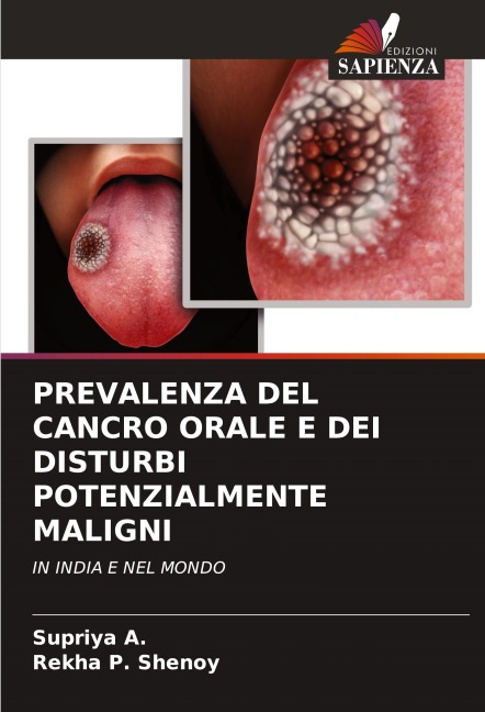 PREVALENZA DEL CANCRO ORALE E DEI DISTURBI POTENZIALMENTE MALIGNI - Supriya A., Rekha P. Shenoy