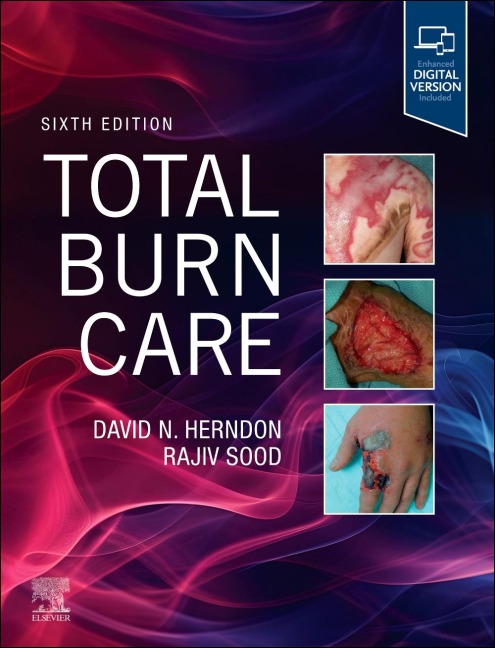 Total Burn Care - 