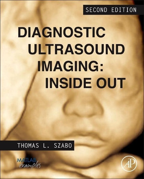 Diagnostic Ultrasound Imaging: Inside Out - Thomas L Szabo