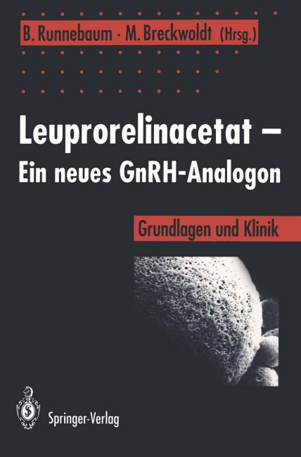 Leuprorelinacetat - Ein neues GnRH-Analogon - 