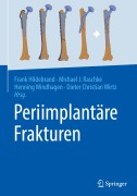 Cover-Bild zum Titel 'Periimplantäre Frakturen' von ''