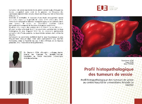Profil histopathologique des tumeurs de vessie - Ousmane Sow, Yaya Sow, Ibou Thiam