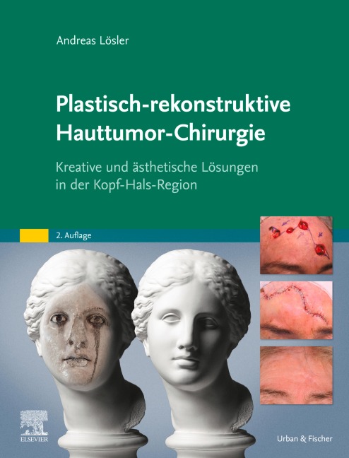 Plastisch-rekonstruktive Hauttumor-Chirurgie - Andreas Lösler