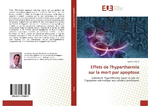 Effets de l'hyperthermie sur la mort par apoptose - Aymeric Morlé