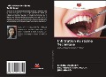 Cover-Bild zum Titel 'Infiltration de résine Technique' von 'Shazia Mahreen, Bhupinder Kaur Padda, Juhi Anand'