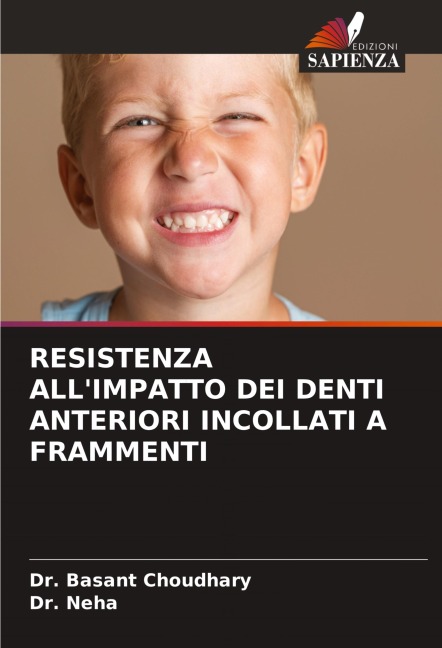 RESISTENZA ALL'IMPATTO DEI DENTI ANTERIORI INCOLLATI A FRAMMENTI - Basant Choudhary, Neha