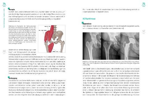 InsideView 6