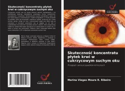 Skuteczno¿¿ koncentratu p¿ytek krwi w cukrzycowym suchym oku - Marina Viegas Moura R. Ribeiro