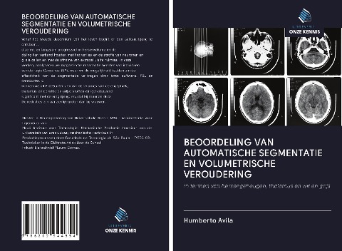 BEOORDELING VAN AUTOMATISCHE SEGMENTATIE EN VOLUMETRISCHE VEROUDERING - Humberto Avila