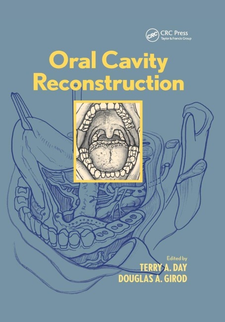 Oral Cavity Reconstruction - 