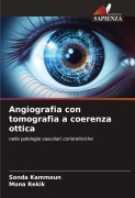 Cover-Bild zum Titel 'Angiografia con tomografia a coerenza ottica' von 'Sonda Kammoun, Mona Rekik'
