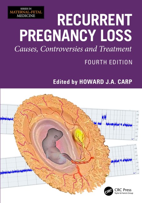 Recurrent Pregnancy Loss - 
