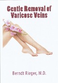 Cover-Bild zum Titel 'Gentle Removal of Varicose Veins' von 'Berndt Rieger'