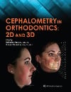  Cephalometry in Orthodontics