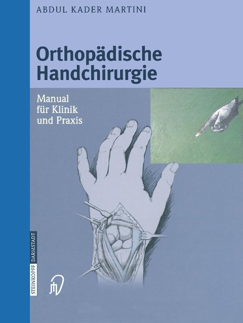 Orthopädische Handchirurgie - Abdul Kader Martini