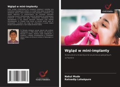 Cover-Bild zum Titel 'Wgl¿d w mini-implanty' von 'Nakul Mude, Ratnadip Lohakpure'