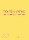  Tooth Wear
