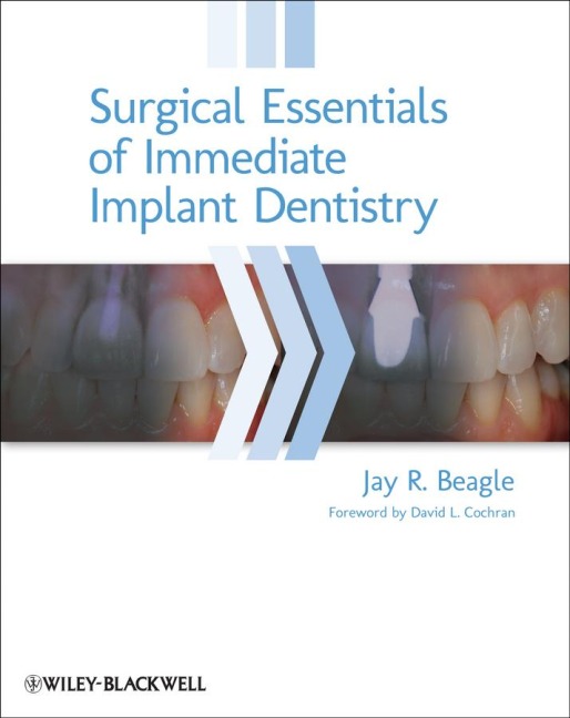 Surgical Essentials of Immediate Implant Dentistry - Jay R Beagle
