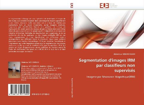 Segmentation d'images IRM par classifieurs non supervisés - Abdenour Mekhmoukh