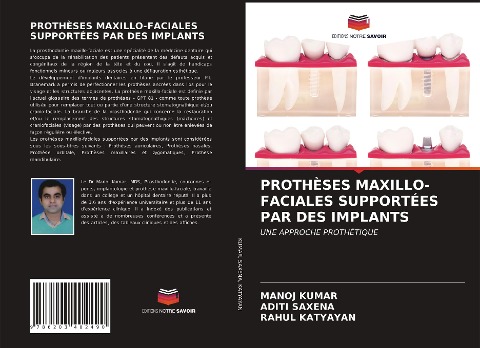 PROTHÈSES MAXILLO-FACIALES SUPPORTÉES PAR DES IMPLANTS - Manoj Kumar, Aditi Saxena, Rahul Katyayan