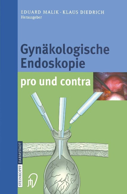 Gynäkologische Endoskopie pro und contra - 