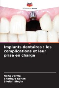 Cover-Bild zum Titel 'Implants dentaires : les complications et leur prise en charge' von 'Neha Verma, Sharique Rehan, Shefali Singla'