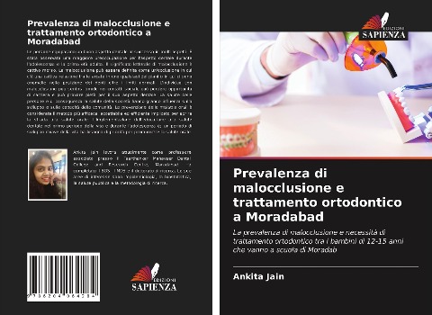 Prevalenza di malocclusione e trattamento ortodontico a Moradabad - Ankita Jain