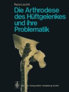 Cover-Bild zum Titel 'Die Arthrodese des Hüftgelenkes und ihre Problematik' von 'R. Liechti'