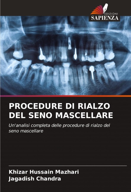 PROCEDURE DI RIALZO DEL SENO MASCELLARE - Khizar Hussain Mazhari, Jagadish Chandra