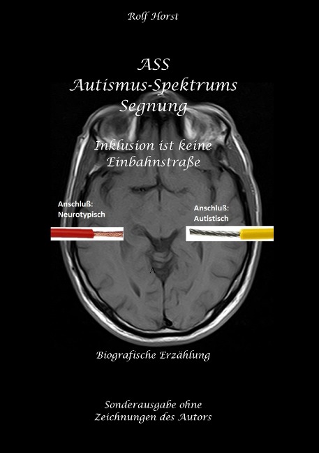 ASS Autismus-Spektrums-Segnung - Inklusion ist keine Einbahnstraße: hochfunktionaler Autismus, Mobbing, Trauma, Sucht, Häusliche Gewalt, Psychotherapie, Umzug, Inklusion, Katholische Kirche, Zen - Rolf Horst