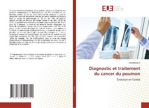 Diagnostic et traitement du cancer du poumon - Hela Kamoun