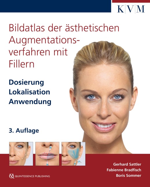 Bildatlas der ästhetischen Augmentationsverfahren mit Fillern - Gerhard Sattler, Boris Sommer, Fabienne Bradfisch