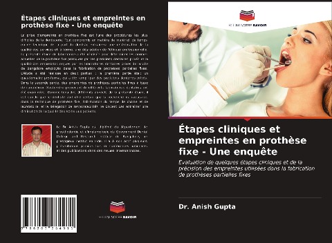 Étapes cliniques et empreintes en prothèse fixe - Une enquête - Anish Gupta